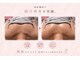 ミモア ローズ(Mimore Roze)の写真