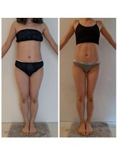 エムプリュ 心斎橋店(M.plus)/オーダーメイドの施術で悩み解決