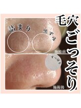 ルネッタ(Lunetta)/