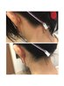 うなじWAX・うなじ剃り 保湿仕上げ