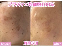 エム 佐賀江北店(EMU)の雰囲気（確実に長年のシミ悩みから卒業！！）