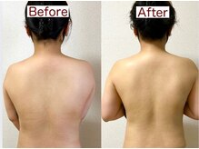 ティーズルーム(T's Room)/全身のムクミ対策