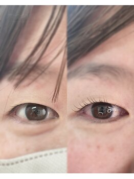 ヴィヴィ(vivi)/ダメージレスマツパ