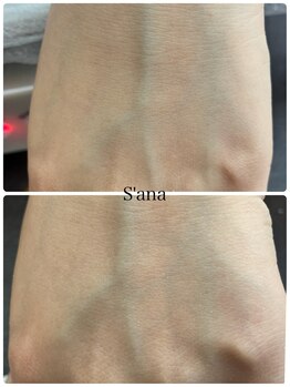 サナ 久が原 千鳥町(S’ana)/ルビッシュ照射