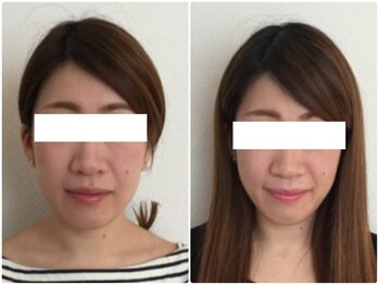 美容整体ウェリナ あま甚目寺院/小顔矯正/骨盤矯正/美脚サロン