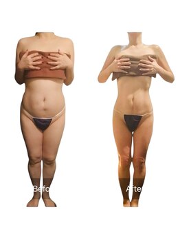 エモーション 横浜関内店(Emotion)/４０代からの本格痩身ダイエット