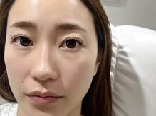 ヴィヴィ(Salon de Vi2)/ケラチンラッシュリフト