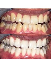 ライトビューティー 池袋店(LightBeauty)/症例写真