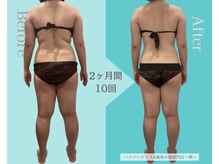 華(hana)の雰囲気（通えば通うほど痩身効果実感◎マッサージの満足度が特に高い！）