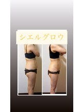 シエルグロウ(CielGrow)/お腹★腰回り　痩身