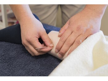 トキハナ アンド アマト(AMATO)/◆施術風景(てい鍼)