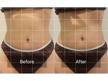 上半身集中痩せ◎プライベートサロンで通いやすい