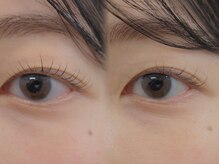 スーコ アイビューティー(suco)/