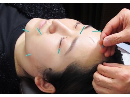 まな鍼灸整骨院【整体/マッサージ/美容鍼/肩こり】の写真