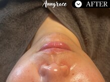 アングレイス(Anngrace)/