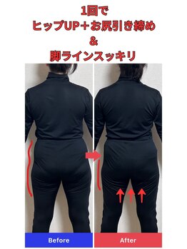 ヨサパーク ハロ(YOSA PARK Haro)の写真/梅雨明けまでに絶対痩せたい方限定★30代からの短期集中ダイエット！最短で結果を出す「劇的変身コース」