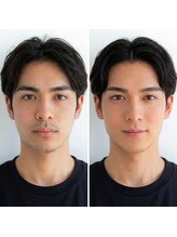 ウィンサムテン 新宿店(Winsome)/脱毛/毛穴洗浄/ヘッドスパ