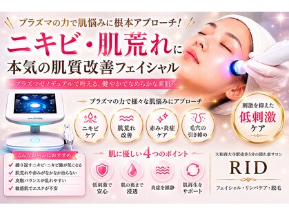 リッド(RID)の写真