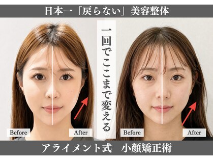 【小顔・姿勢に特化したサロン】美容整体 Alignment TOKYO 横浜の写真