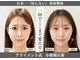 【小顔・姿勢に特化したサロン】美容整体 Alignment TOKYO 横浜の写真