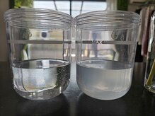 エターナル(Eternal)/毛穴の汚れにビックリ！！