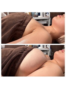 アイミーボーテ(Aime beaute)/バストアップ【デコルテ】