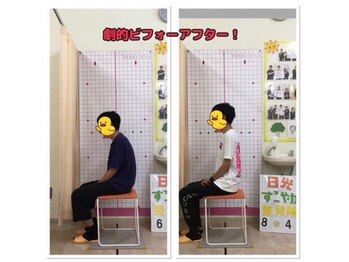 すこやか整骨院 陽南店/ビフォーアフター