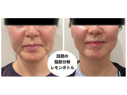 フルーア(FULUA)の写真