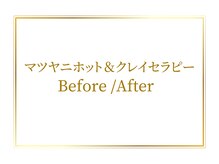 オリエンタル ルボワール(oriental Revoir)/マツヤニホット＆クレイセラピー