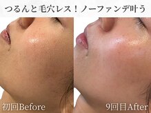 芯美 恵比寿店(shinbi)/アンストレス/オプティル