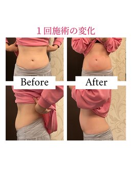 モモ 三ノ宮店(momo)/1回の変化☆