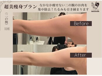 ラブミー 渋谷本店(LoveMe)/【渋谷・痩身】骨盤矯正/二の腕