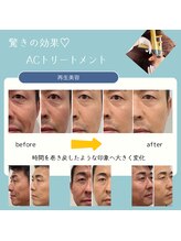 トータルサロン ヴィータ(VITA.)/【NEW】グランAC始まりました！