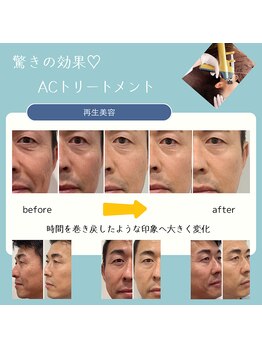 トータルサロン ヴィータ(VITA.)/【NEW】グランAC始まりました！