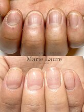 マリーロール 淀屋橋本店(Marie Laure)/自爪育成/深爪矯正/ネイルケア