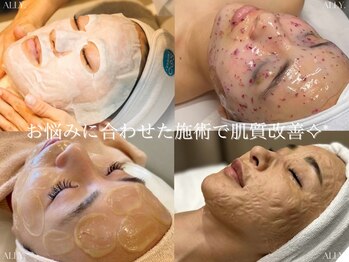 アリー(ALLY)/同時施術できます☆☆