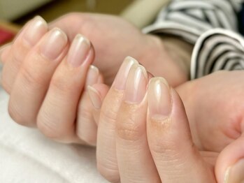 サロン ド アンサンブルの写真/【爪が薄い方や形が気になる方・割れやすい方に◎】爪を綺麗に整え、健康的な美フォルムに仕上げます♪