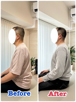 イデアル(iDeal)/猫背姿勢が改善!!