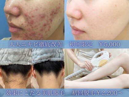エピア 豊橋店(Epia)の写真