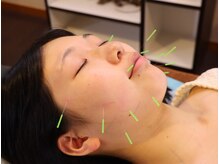 なみつき鍼灸整骨院