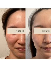 ひっそり美肌構築/ブライダル♪