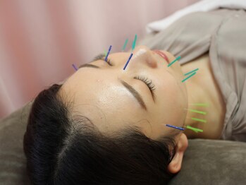 同心整体院の写真/《通いやすさNO１》初めての方にもおススメ！《美容鍼30分¥2,500》ニキビケア等お肌のトラブル改善にも◎