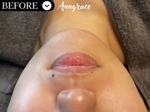 アングレイス(Anngrace)/