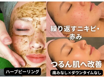 ウェリナベル(WelinaBelle)の写真