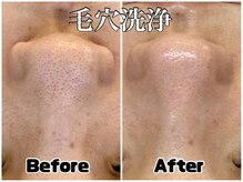 アンドエミニー エン ラボーテ(& EMINY 艶 la beaute)の雰囲気（毛穴の詰まり・ざらつきをケアして透明感のある滑らか肌へ）