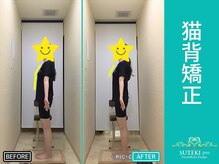 美骨矯正 ステキプロ(SUTEKI pro)/巻肩・猫背改善・全身矯正