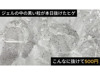 美容脱毛専門サロン エピラージュ 新宿店(Epilage)/爆抜けのヒゲ脱毛