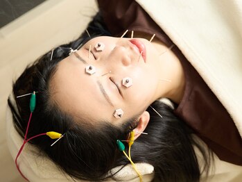 アーチ(Arch)/美容鍼×低周波