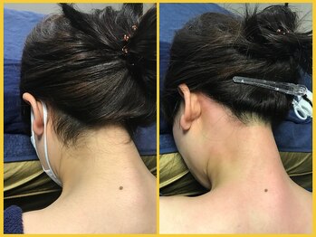 クラウン ジュエルズ(CROWN JEWELS)/【Wax脱毛】うなじ サイド 7