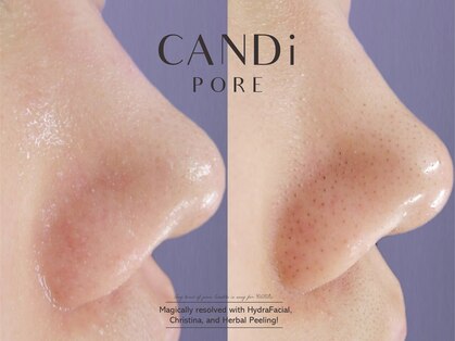 キャンディ 難波心斎橋店(CANDi)の写真